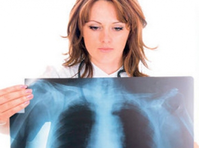 Akciğer Kanserine Neden Olan Faktörler
