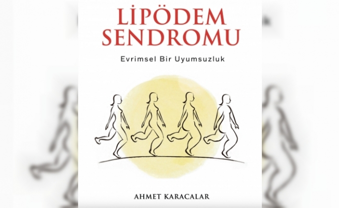 Kendinizi Şişman Sanırken Aslında Lipödem Olabilir Misiniz?